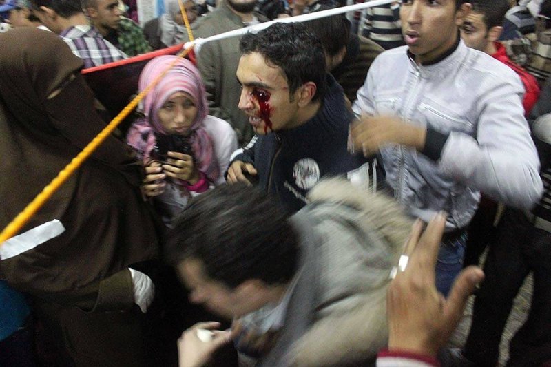 إصابات، مصابون، عنف الشرطة، ثورة 25 يناير